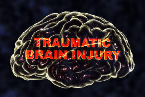 chronic traumatic encephalopathy